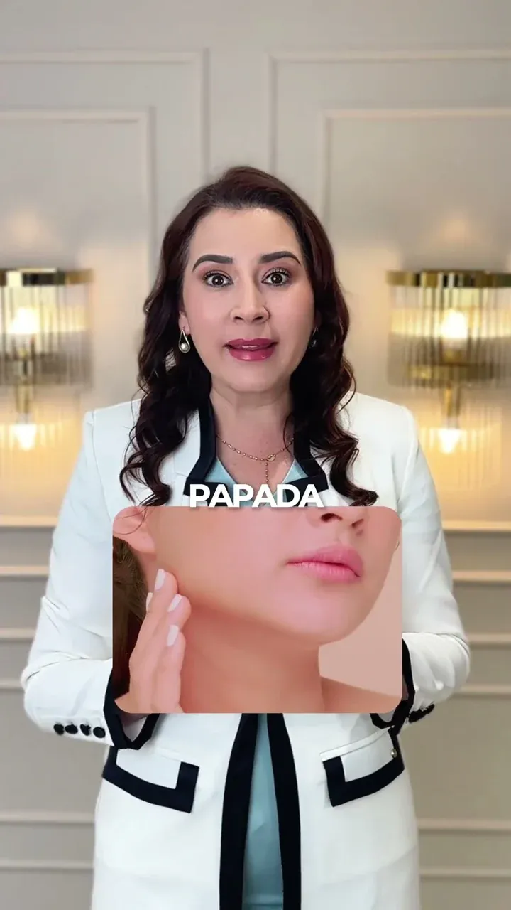 Especialista de Kalos explica el tratamiento de papada con Endolift