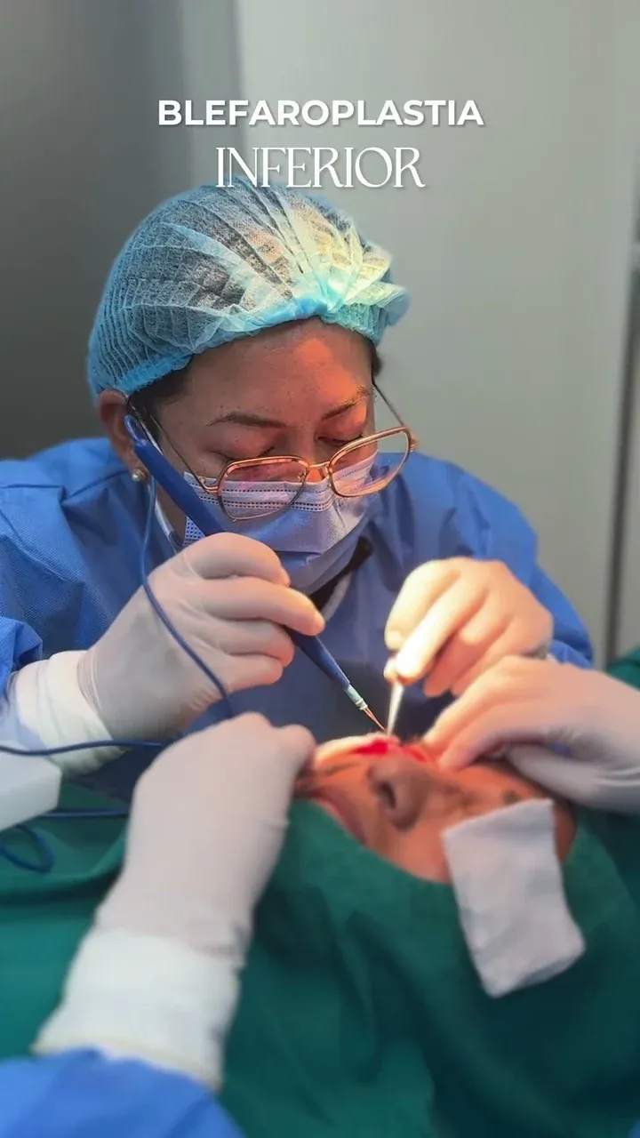 Cirugía de blefaroplastia inferior en quirófano