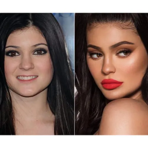 Kylie Jenner
