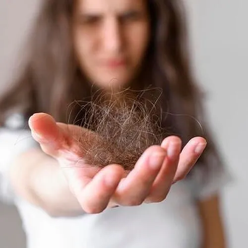 Alopecia, ¿cómo puede afectar a nivel psicológico?