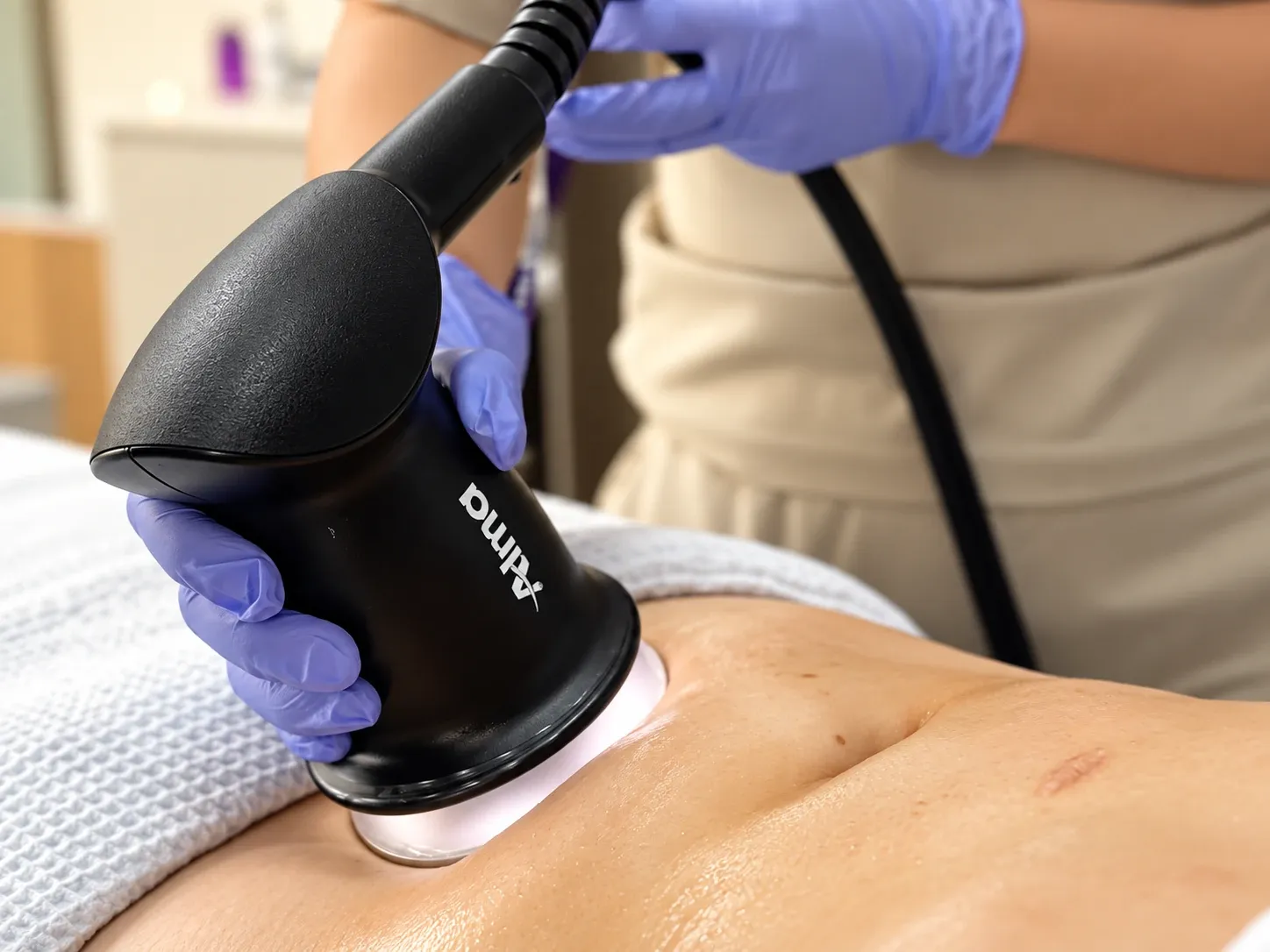 Tratamiento corporal con un equipo Alma sobre el abdomen de una paciente