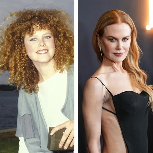 Nicole Kidman (Antes y después).