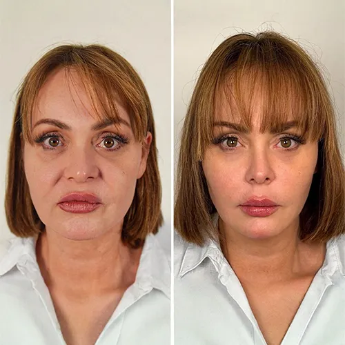 ¿Qué se hizo Gaby Spanic?