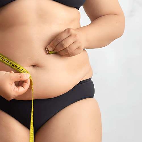 ¿Grasa localizada o hinchazón? 