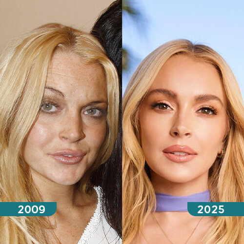 Lindsay Lohan (ANTES / AHORA)