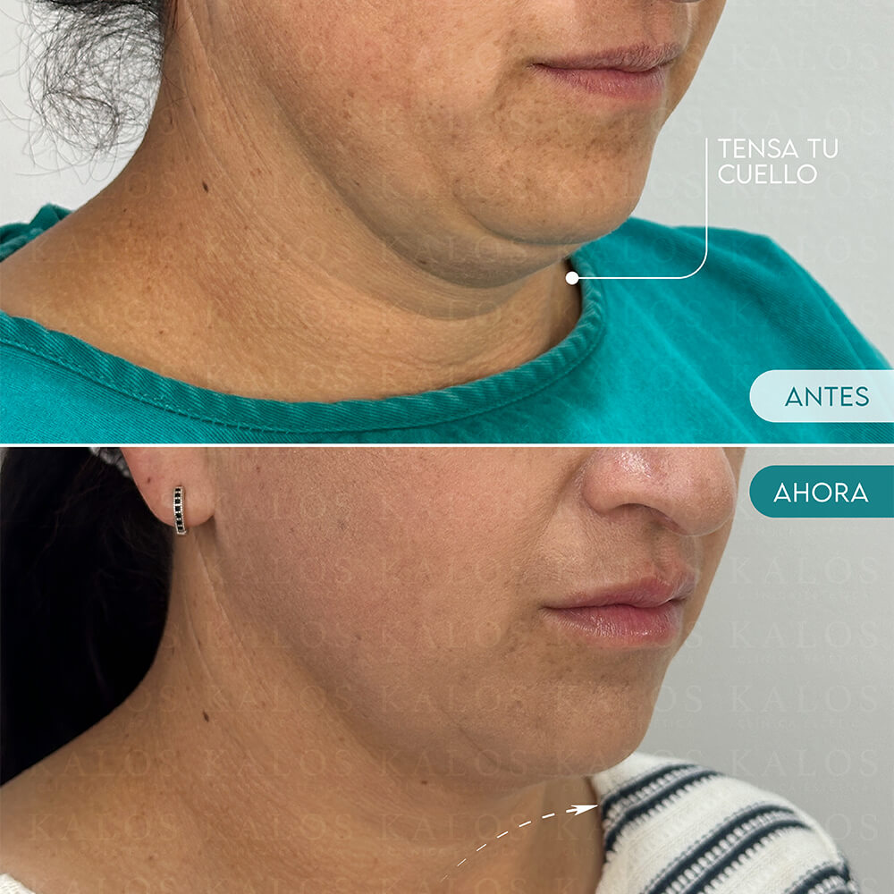 Mesa de trabajo 1 (1)