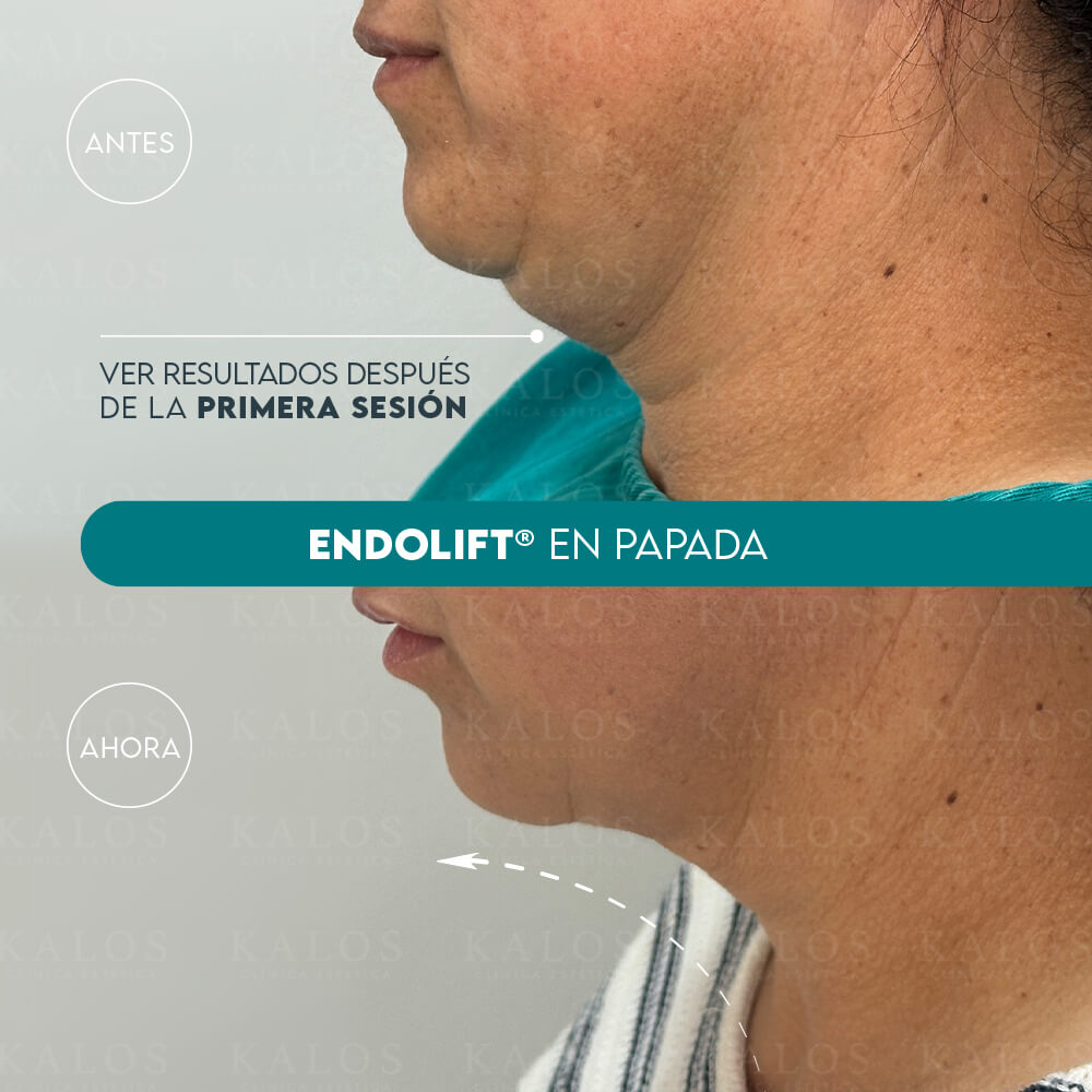 Mesa de trabajo 2 (1)