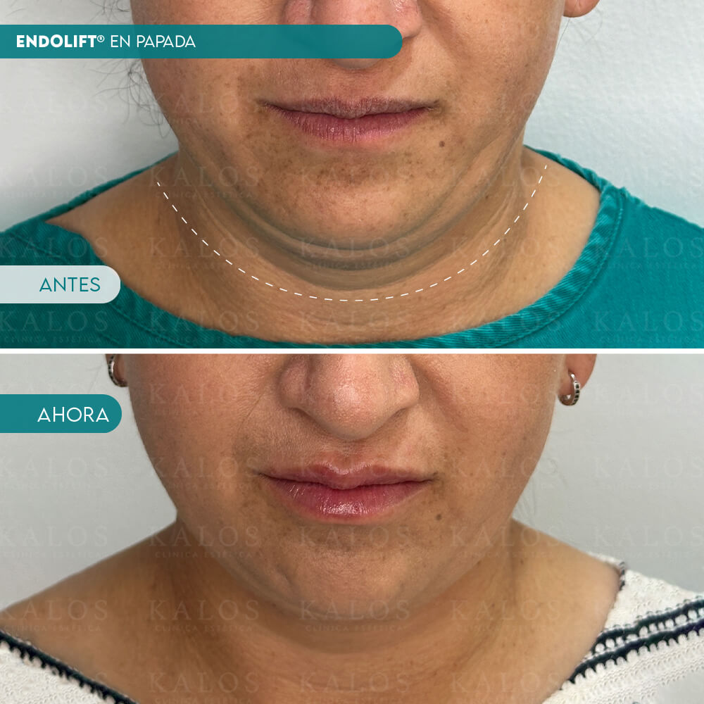 Mesa de trabajo 3 (1)