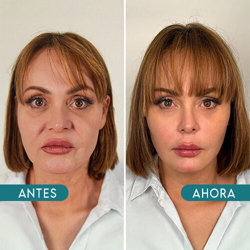 ¿Qué se hizo Gaby Spanic?