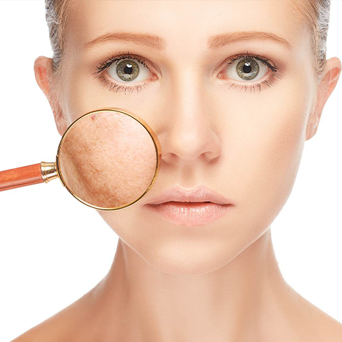 ¿Por qué aparecen las manchas en la piel?