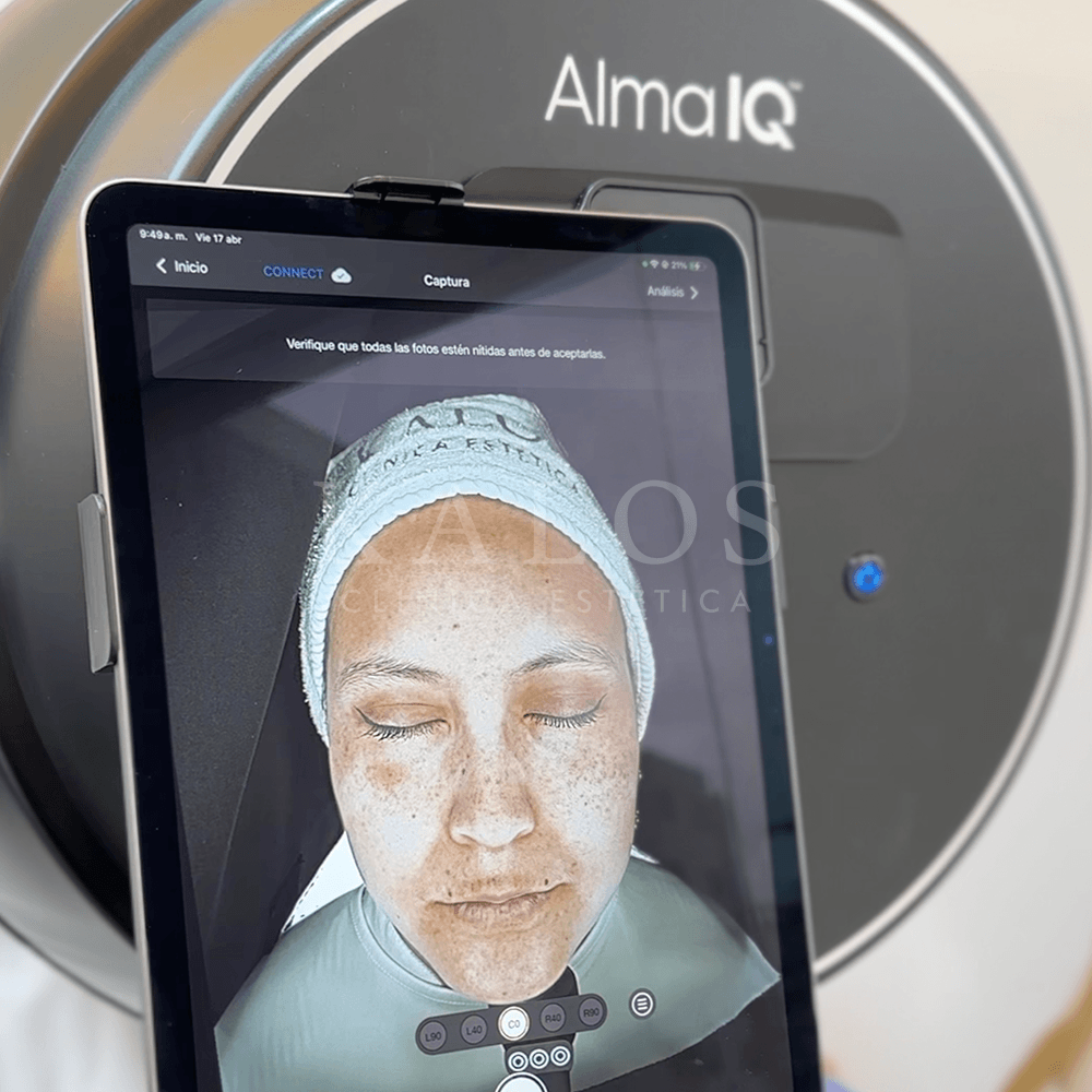 ALMA IQ KALOS (1)