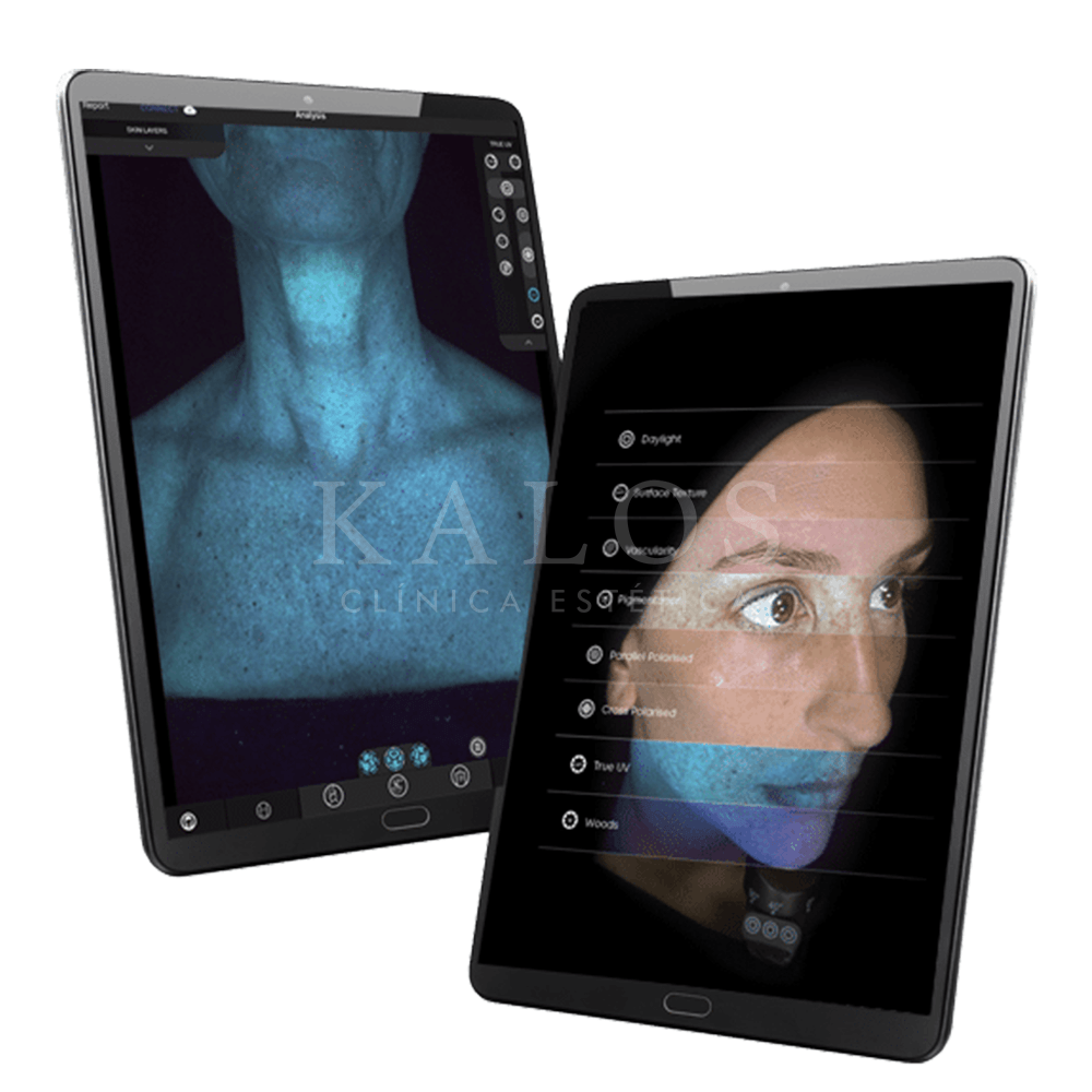 ALMA IQ KALOS (2)