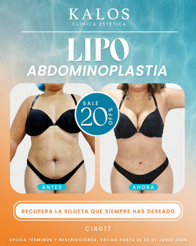 LIPO ABDOMINOPLASTIA